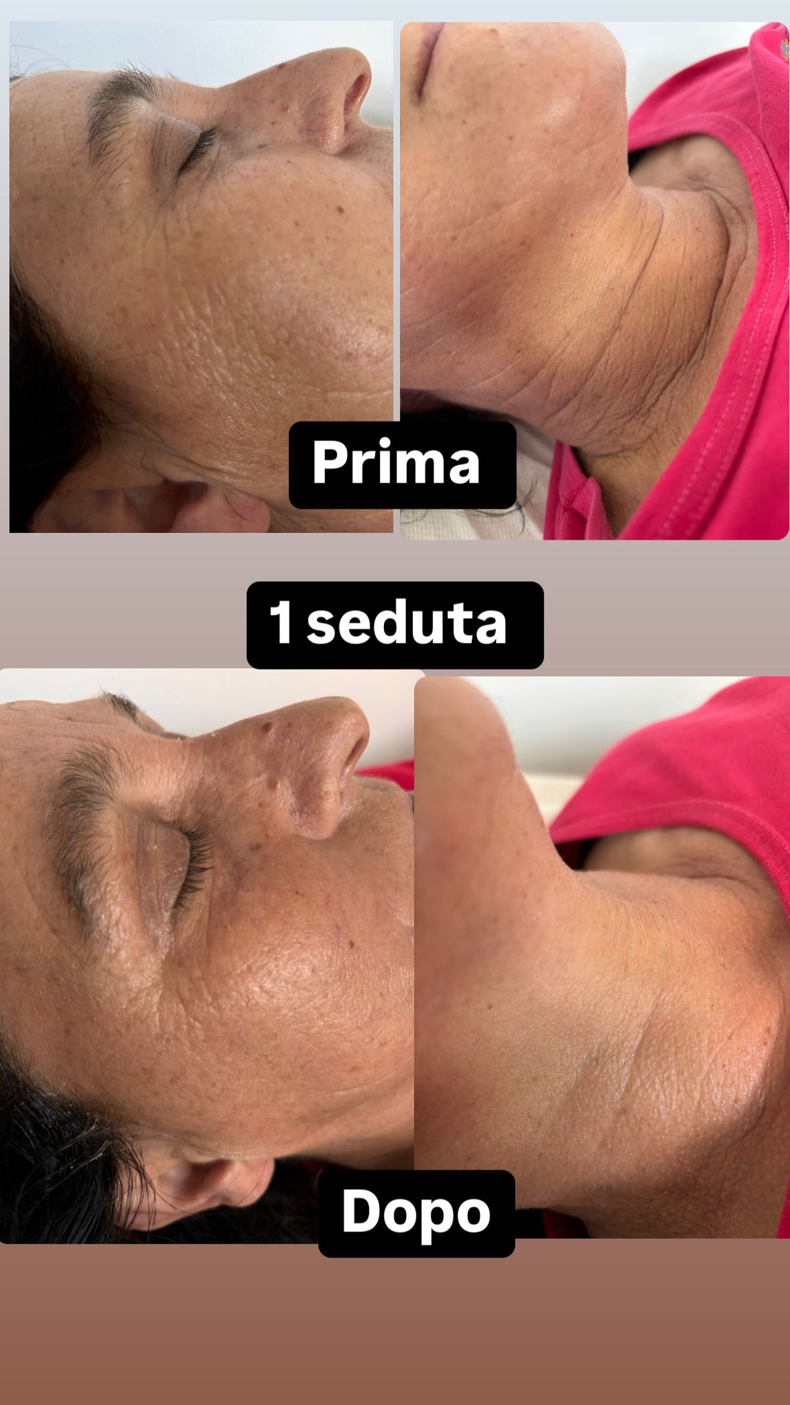 Risultato estetista 2